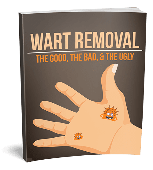 Wart Removal