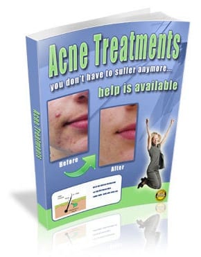 Acne Treatments - digital ebook with PLR resell rights for clear skin solutions