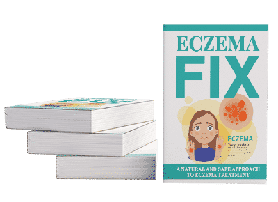 Eczema fix digital guide with PLR resell rights showing skin relief strategies