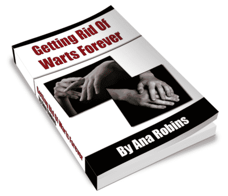 Getting Rid Of Warts Forever: natural remedy, PLR digital download to eliminate warts in 3 days