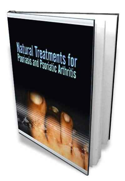 Natural treatments for psoriasis and psoriatic arthritis ebook with PLR resell rights instant download