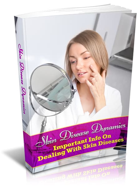 Skin Disease Dynamics book cover on skin health, acne, eczema, psoriasis guide with resell rights